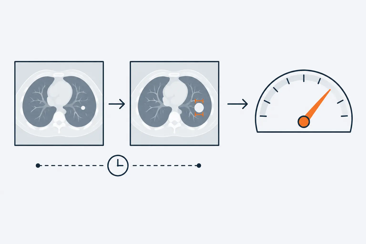 Two CT slices show the same lung nodule on an earlier and a later scan, larger the second time. An arrow leads on from the later scan to a dial whose orange needle points toward the high end.